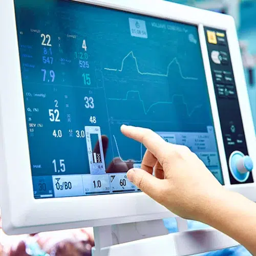 7 Important Facts About Borderline ECG You Should Never Ignore 