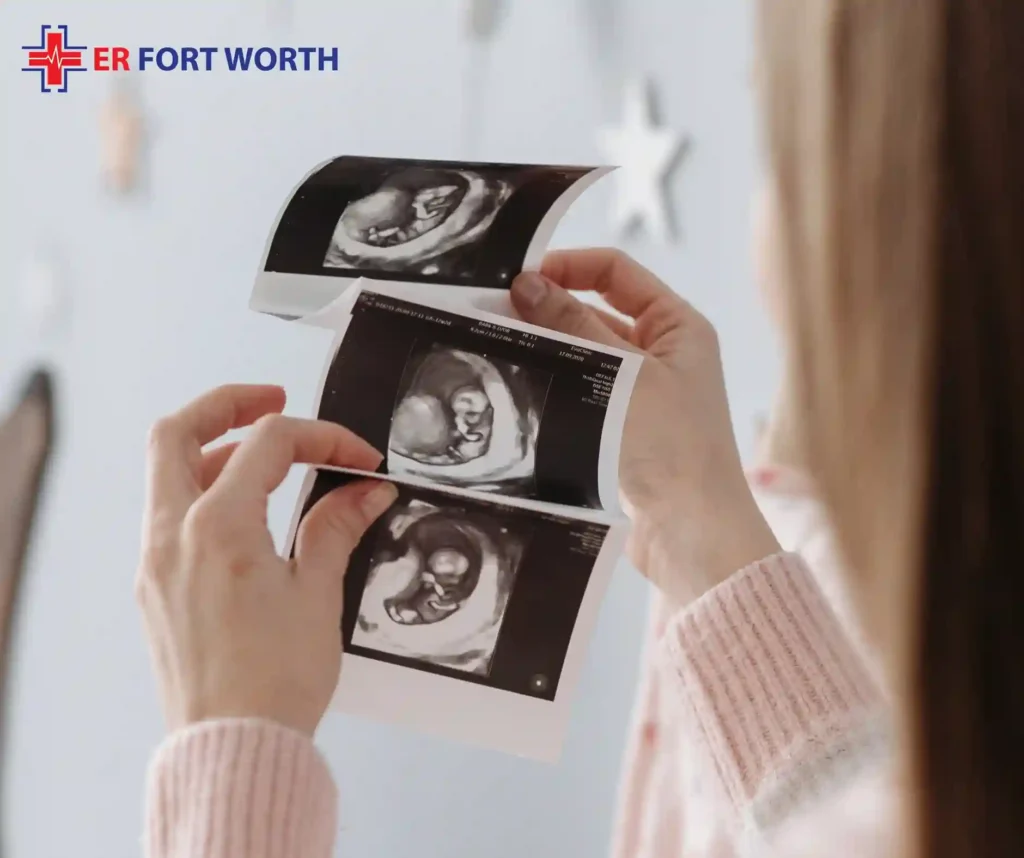 3d ultrasound fort worth
