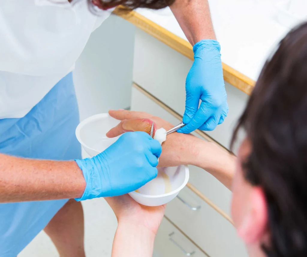 Burns Treatment Emergency Care